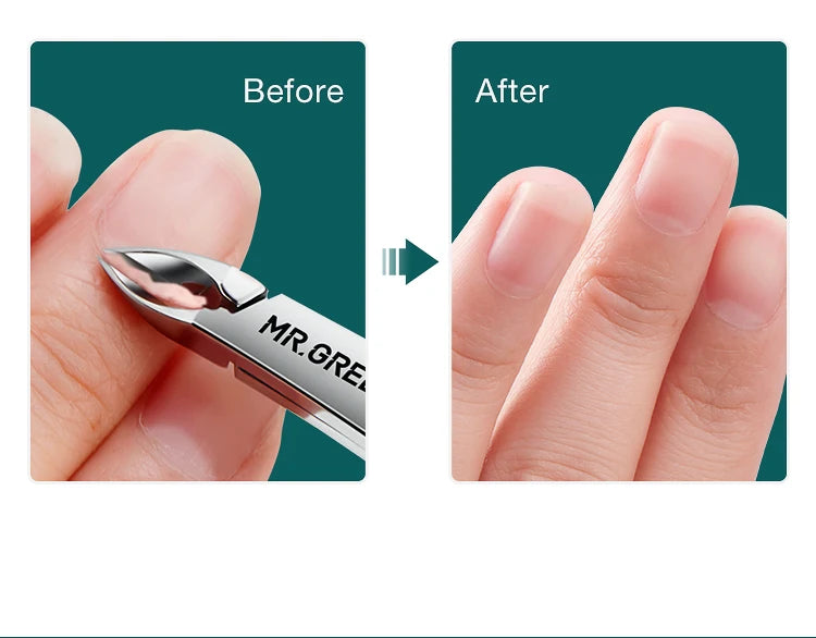 MR.GREEN Professional Stainless Steel Cuticle Nipper & Manicure Scissors — Precision Cuticle Trimmer and Pusher Tool