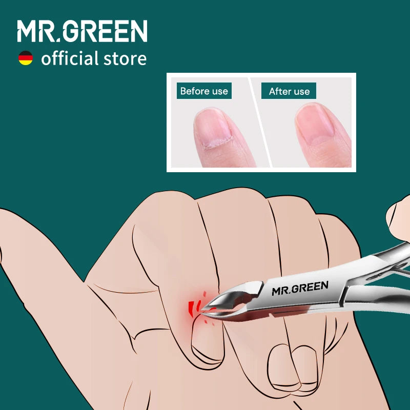 MR.GREEN Stainless Steel Cuticle Nippers - Precision Cuticle Clippers & Trimmer for Manicure Pedicure