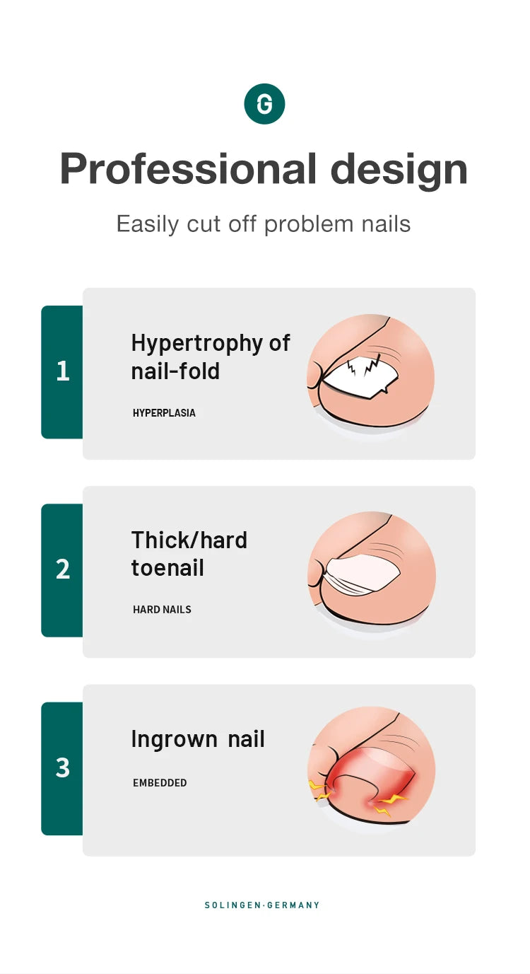 MR.GREEN Ingrown Toenail Clippers – Stainless Steel Precision Toenail Cutter for Thick Nails