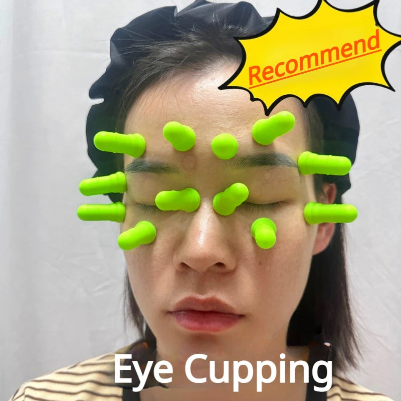 12-Pack Silicone Eye Cupping Cups – Facial Vacuum Massage Set for Eye Fatigue Relief & Brightening