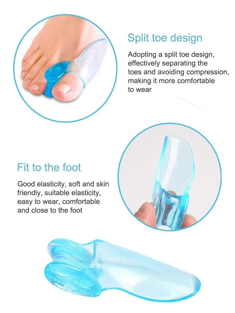 2-Pack Silicone Toe Spacer Gel Separators for Bunion Relief – Large Toe Aligners for Hallux Valgus & Toe Correction
