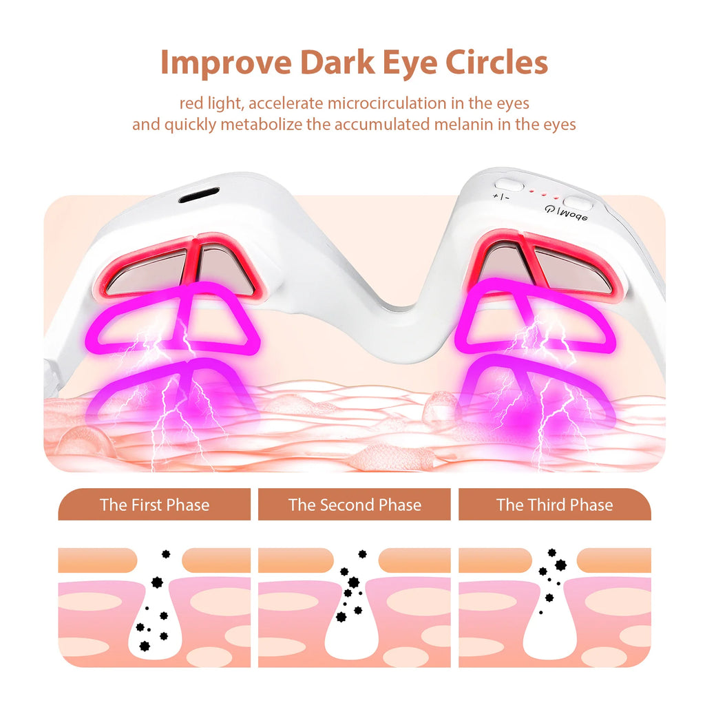 3D EMS Eye Massager - Anti-Aging Red Light Therapy for Dark Circles, Wrinkles & Eye Fatigue Relief