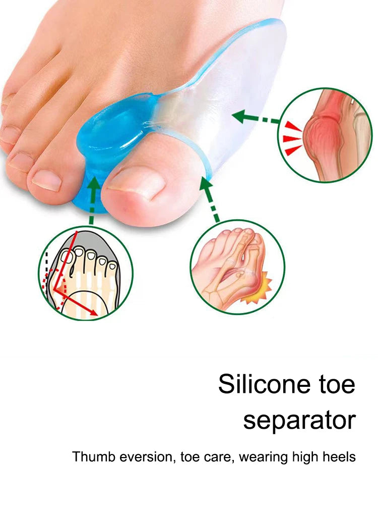 2-Pack Silicone Toe Spacer Gel Separators for Bunion Relief – Large Toe Aligners for Hallux Valgus & Toe Correction