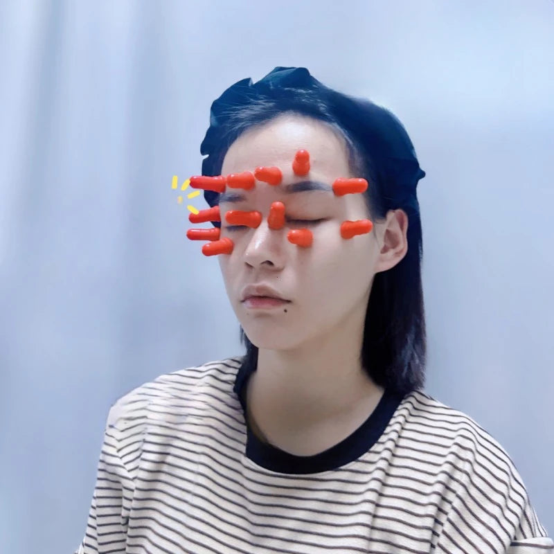 12-Pack Silicone Eye Cupping Cups – Facial Vacuum Massage Set for Eye Fatigue Relief & Brightening