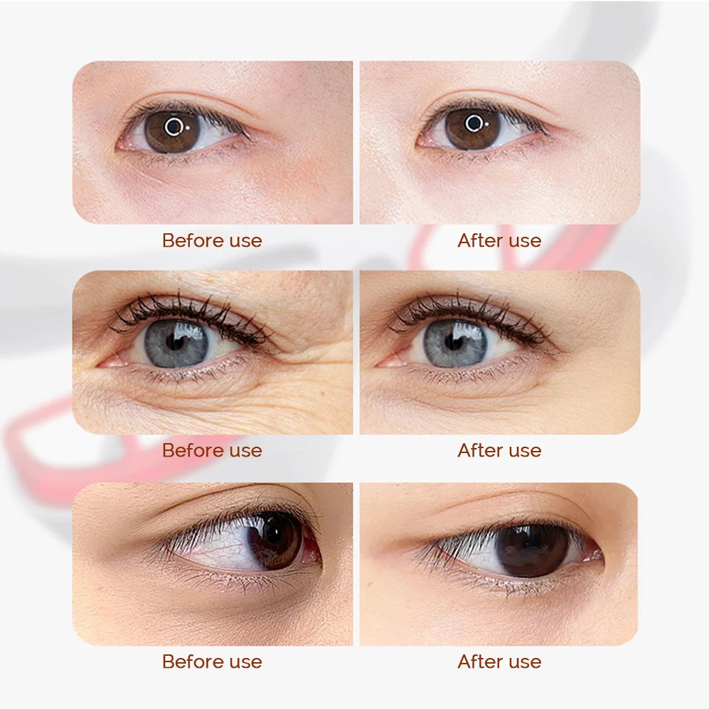 Wireless USB-C Eye Massager — 3-Mode Heat & Red Light for Dark Circles, Puffiness & Eye Fatigue