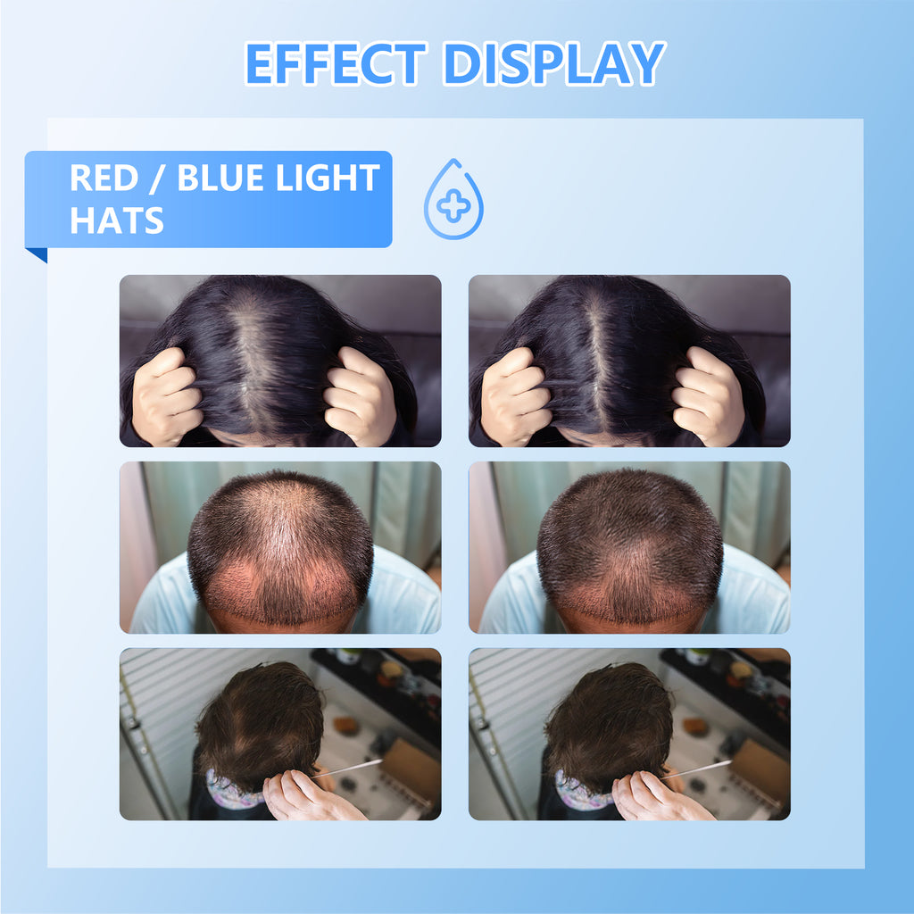 KTS Red Light Therapy Hair Growth Cap – USB-Powered Scalp Massager for Men & Women